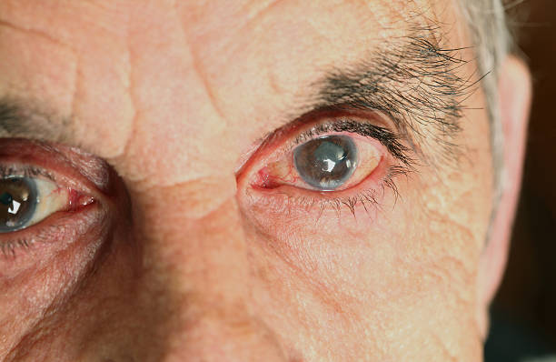dangers of glaucoma